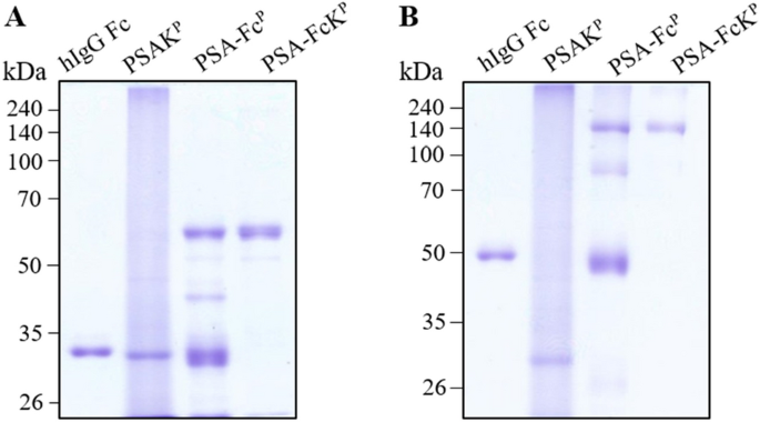 Immobilization of the IgG and Prostate Specific Antigen (PSA) on SU-8