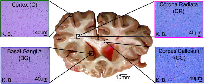 Fifty Shades of Brain: A Review on the Mechanical Testing and Modeling of Brain  Tissue | Archives of Computational Methods in Engineering