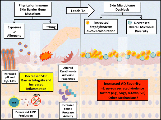 Taming Staphylococcus aureus in the eczema skin microbiome