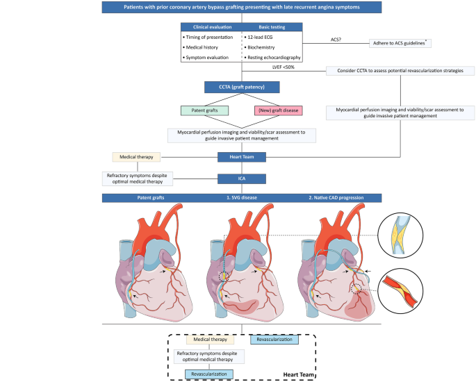 Critical Analysis of Coronary Artery Bypass Graft Surgery: A 30