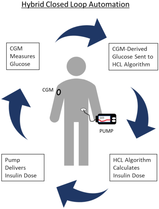 Continuous Glucose Monitor, Insulin Pump, and Automated Insulin