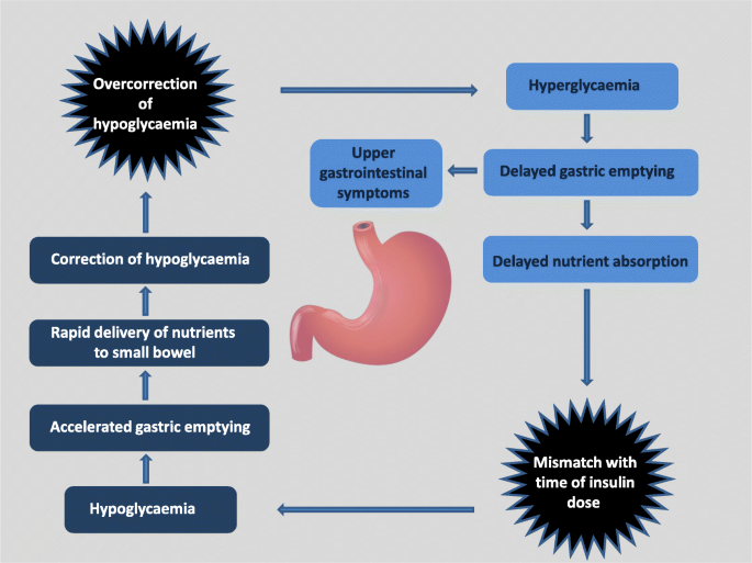 Diabetic Gastroparesis and Glycaemic Control | Current Diabetes Reports
