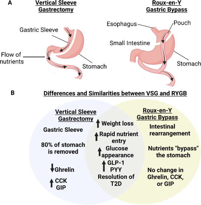 gastric bypass and glp 1 Gut Factors Mediating the Physiological Impact of Bariatric Surgery |  Current Diabetes Reports