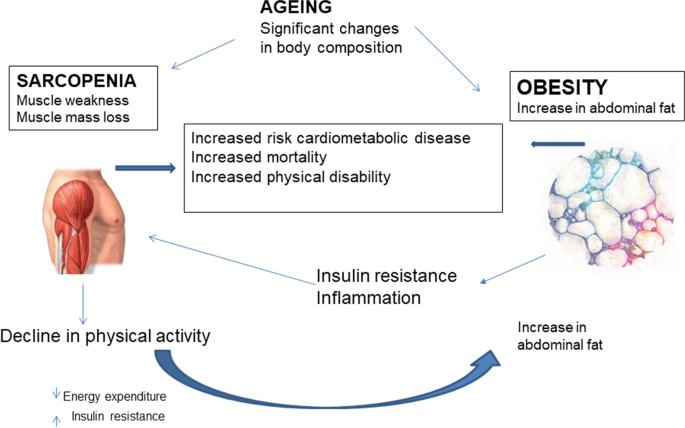 Sarcopenic Obesity and Cardiometabolic Health and Mortality in Older Adults: a Growing Health Concern in an Ageing Population