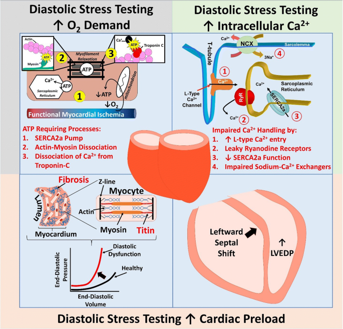 Should We Test for Diastolic Dysfunction? How and How Often