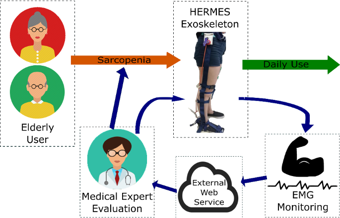 Smart health: the use of a lower limb exoskeleton in patients with  sarcopenia | International Journal on Interactive Design and Manufacturing  (IJIDeM)