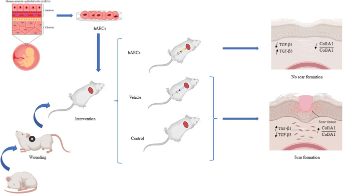 Effects of Placenta-Derived Human Amniotic Epithelial Cells on the Wound  Healing Process and TGF-β Induced Scar Formation in Murine  Ischemic-Reperfusion Injury Model