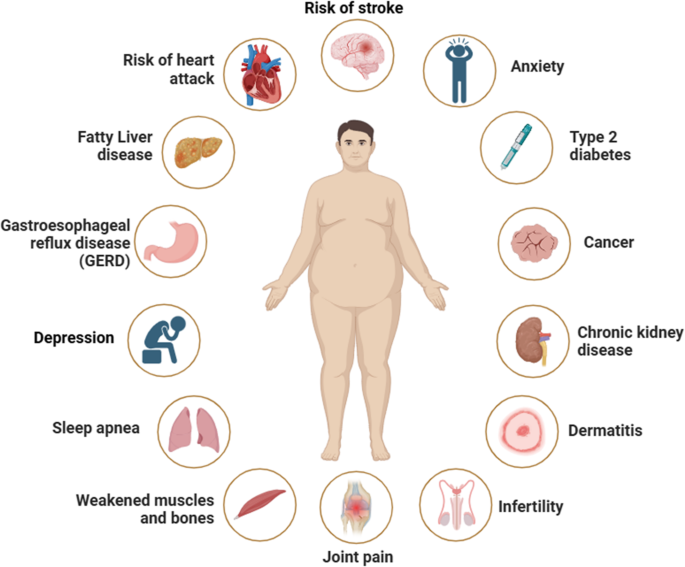 Anti-obesity drugs: comprehensive review and emerging therapies | Endocrine 