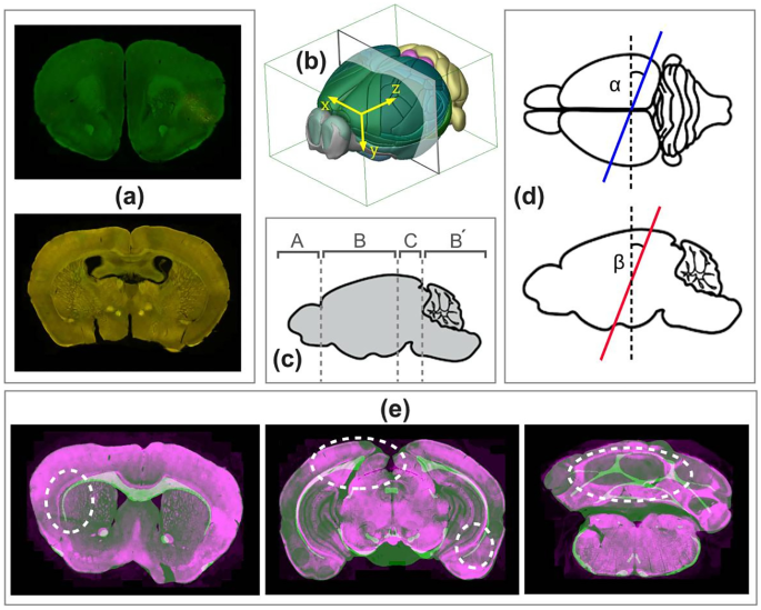 DeepSlice: rapid fully automatic registration of mouse brain imaging to a  volumetric atlas