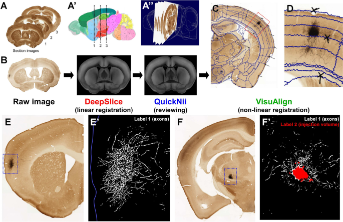 DeepSlice: rapid fully automatic registration of mouse brain imaging to a  volumetric atlas