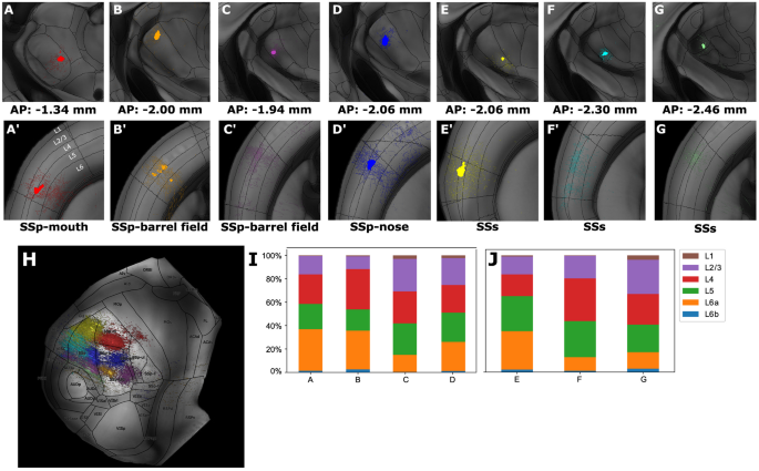 DeepSlice: rapid fully automatic registration of mouse brain imaging to a  volumetric atlas