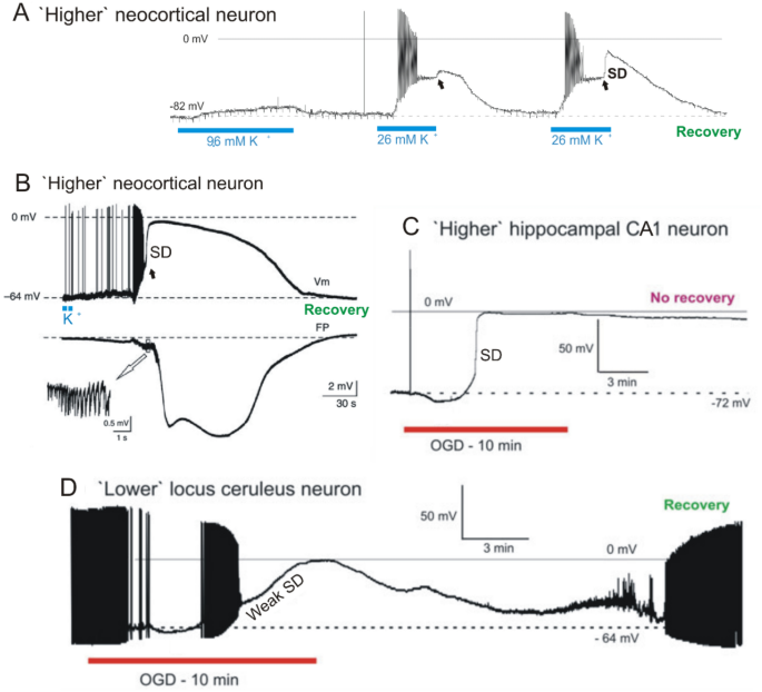 The Critical Role of Spreading Depolarizations in Early Brain Injury: Consensus and Contention