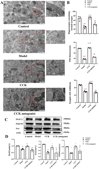 Cholecystokinin Signaling can Rescue Cognition and Synaptic Plasticity in  the APPPS1 Mouse Model of Alzheimer's Disease | SpringerLink