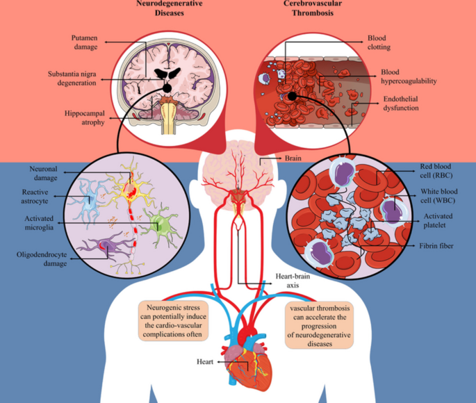 Role of Thrombosis in Neurodegenerative Diseases: An Intricate Mechanism of  Neurovascular Complications | Molecular Neurobiology
