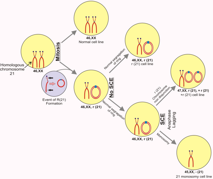 Trisomy 13: MedlinePlus Genetics
