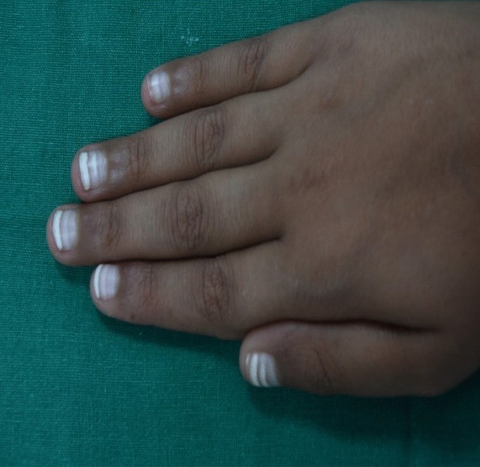 Nailanalysis - MicroTrace Minerals