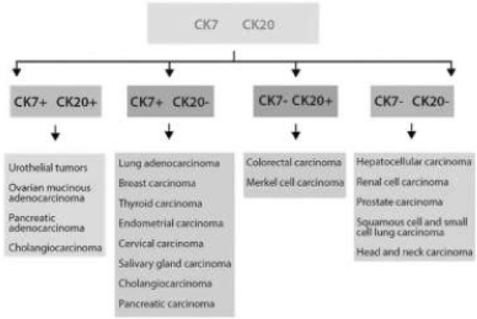 Ck7+ ck20+ tumors