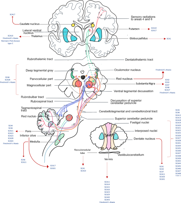 A Review of Ocular Movement Abnormalities in Hereditary Cerebellar Ataxias | The Cerebellum