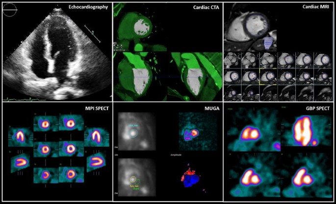 Multimodality imaging of the left ventricle: Choosing soundly | Journal of  Nuclear Cardiology