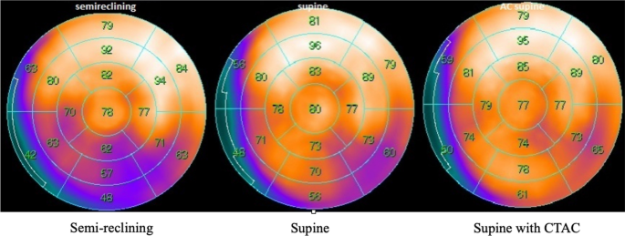 3 Ways Upright Cardiac Imaging Is Different From Supine