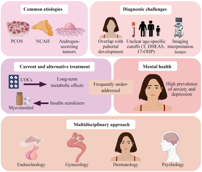 Adolescent hyperandrogenism: diagnostic challenges and therapeutic approaches | World Journal of Pediatrics | Springer Nature Link Adolescent hyperandrogenism: diagnostic challenges and therapeutic approaches | World Journal of Pediatrics | Springer Nature Link
