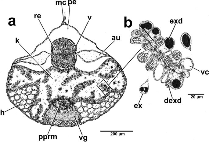Vulva opening with funnel-shaped protruding ovijector in Aonchotheca