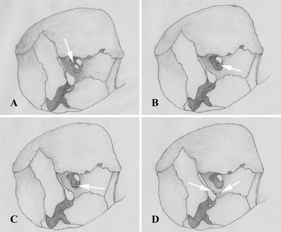 Osteologia e sindesmologia