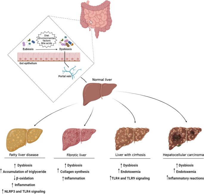 benefits of lupoid glutathione Effects of Probiotics on Liver Diseases: Current In Vitro and In Vivo  Studies | Probiotics and Antimicrobial Proteins