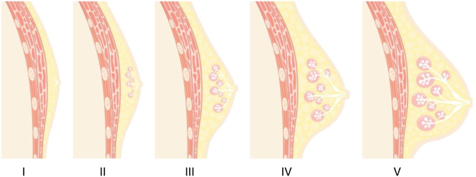 Anatomy of an adult female breast (blue thin arrow = duct; green