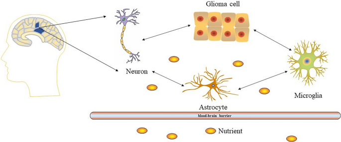 increased glutathione levels gliomas Expression of gamma-glutamyltransferase 1 in glioblastoma cells confers resistance to cystine deprivationinduced ferroptosis Oncology Letters