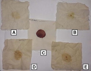 Removing blood stains from cloth. The protease (5 U/ml) was incubated