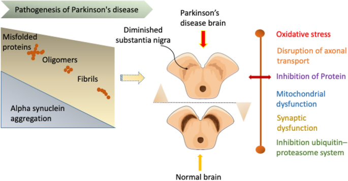 An update on pathogenesis and clinical scenario for Parkinson's disease:  diagnosis and treatment | 3 Biotech | Springer Nature Link