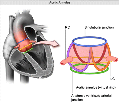 Frontiers | Mitral Annular Forces and Their Potential Impact on  Annuloplasty Ring Selection