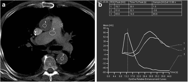 Contrast medium injection protocol for CT angiography with CT
