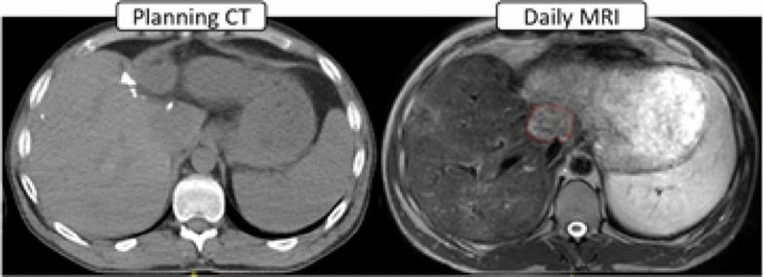 ACPSEM position paper: the safety of magnetic resonance imaging