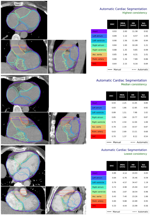 Deep learning-based segmentation of the thorax in mouse micro-CT scans