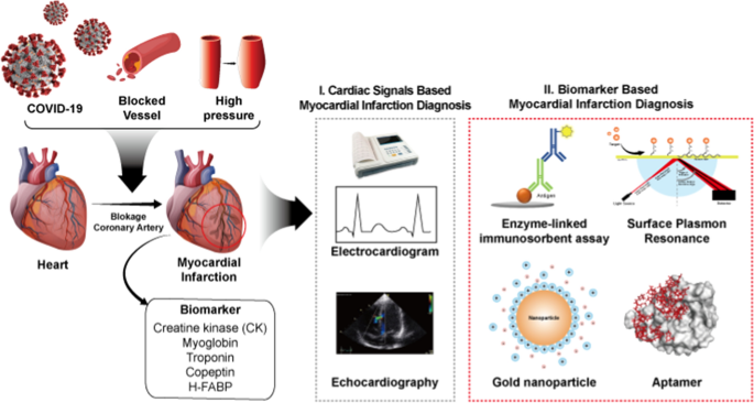 creatine kinase in myocardial infarction