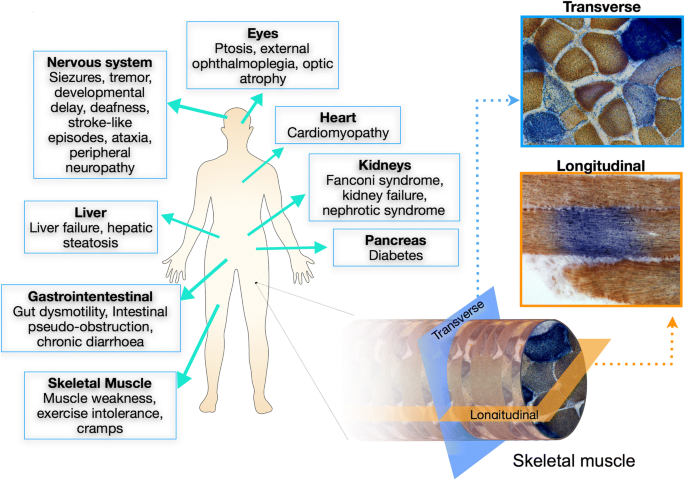 Diagnosis and Treatment of Mitochondrial Myopathies | Neurotherapeutics |  Springer Nature Link