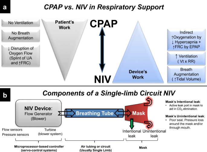 Sleep-Related Breathing Disorders: When CPAP Is Not Enough | Neurotherapeutics Sleep-Related Breathing Disorders: When CPAP Is Not Enough | Neurotherapeutics