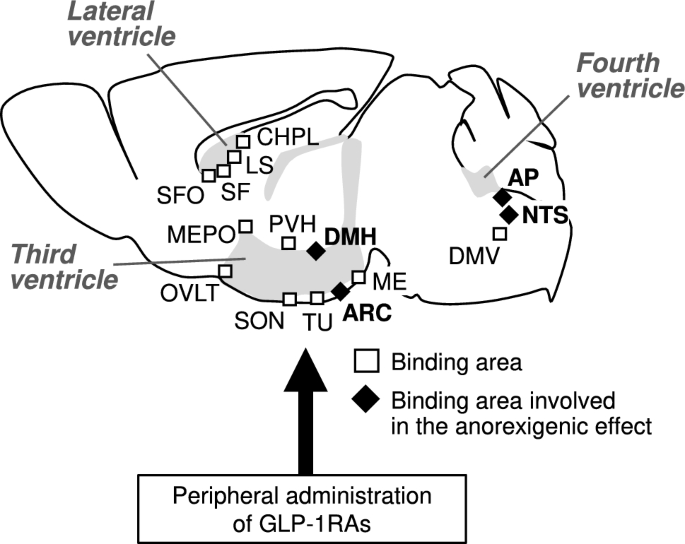 glp-1 vomiting class action in west virginia Comparing the anorexigenic effects and mechanisms of gut-derived GLP-1 and  its receptor agonists: insights into incretin-based therapies for obesity |  Diabetology International