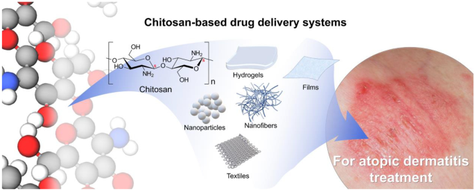 Chitosan-based drug delivery systems for skin atopic dermatitis: recent  advancements and patent trends | Drug Delivery and Translational Research