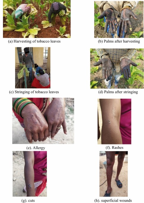 green tobacco sickness symptoms Assessments of occupational health hazards of tobacco farmworkers in Andhra  Pradesh, India | Toxicology and Environmental Health Sciences