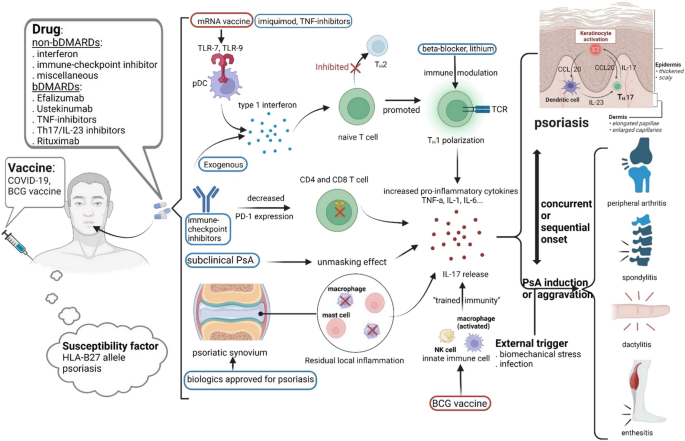 Image result for Unmasking the Culprits: What Really Causes Plaque Psoriasis? infographics