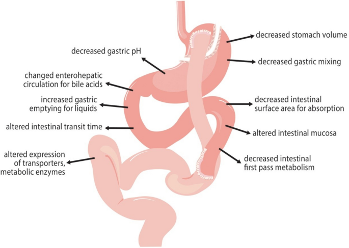 glp 1 medication for pcos How GLP-1 Medications Can Help with PCOS