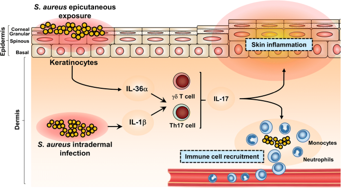 Adipocytes Armed against Staphylococcus aureus