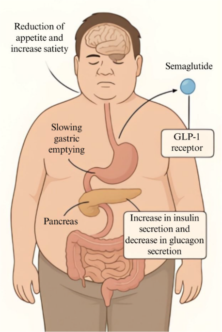 body soreness tirzepatide Tirzepatide: How Does It Work for Weight Loss? │ Pharmacology