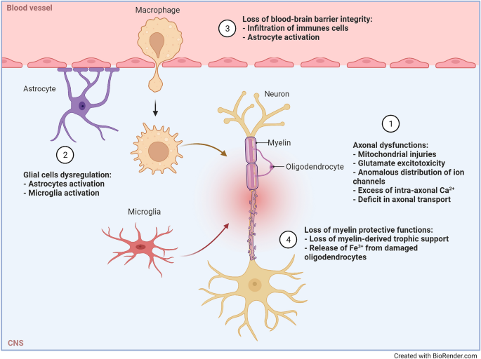 Frontiers  Therapeutic Advances in Multiple Sclerosis