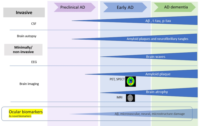 Early identification of Alzheimer's disease in mouse models