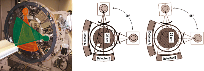 EMI Scanner Mark 1 - The First CT, Sir Godfrey Hounsfield i…