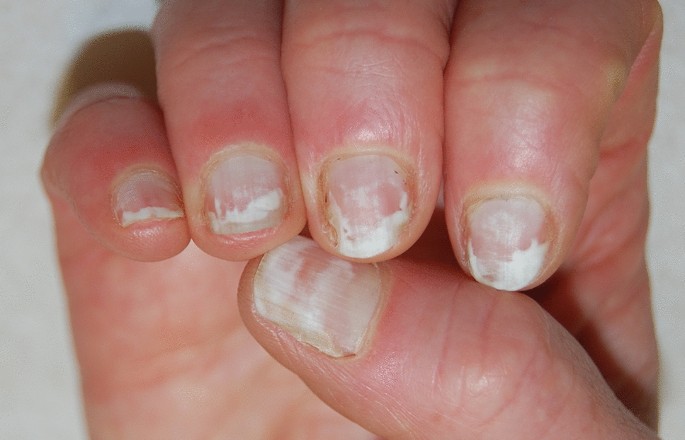 43+ White Nails Reason Images | White nails, Nails, Nail art